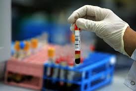 Blood test may show if prostate cancer treatment is working